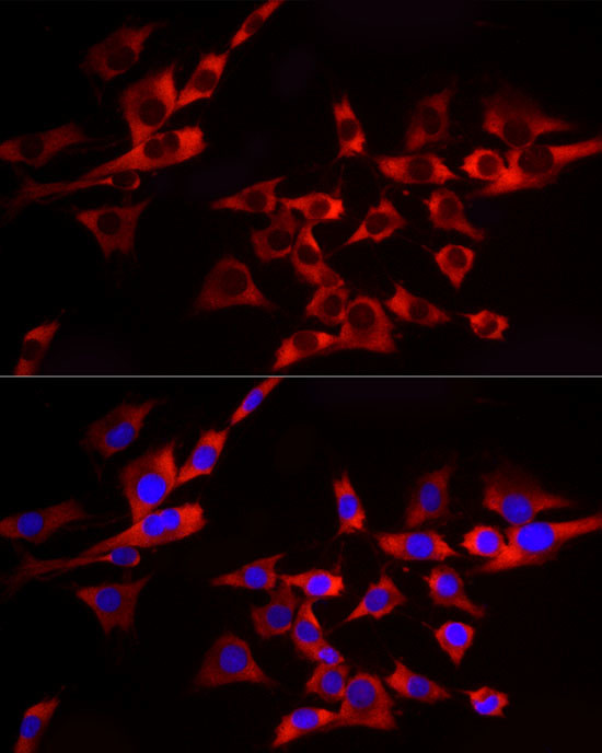 EIF4A1/EIF4A2/EIF4A3 Antibody in Immunocytochemistry (ICC/IF)