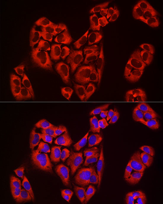 EIF4A1/EIF4A2/EIF4A3 Antibody in Immunocytochemistry (ICC/IF)