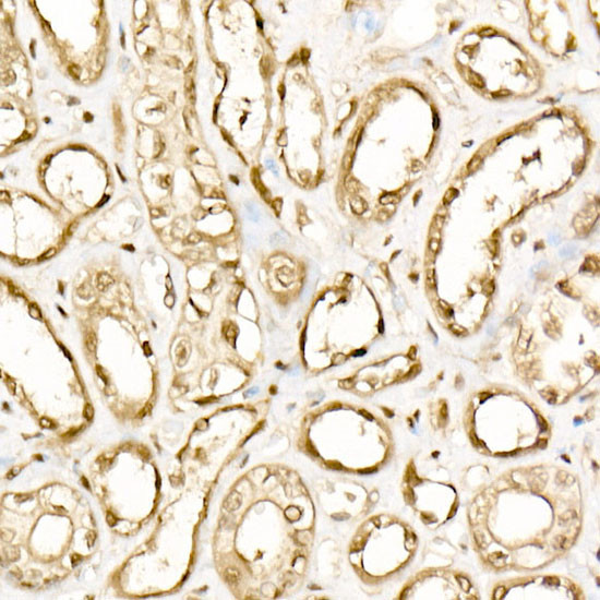 EIF4A1/EIF4A2/EIF4A3 Antibody in Immunohistochemistry (Paraffin) (IHC (P))