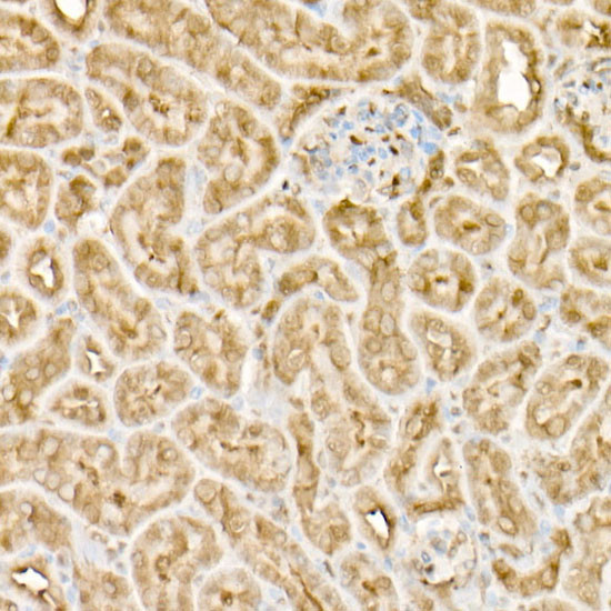 EIF4A1/EIF4A2/EIF4A3 Antibody in Immunohistochemistry (Paraffin) (IHC (P))