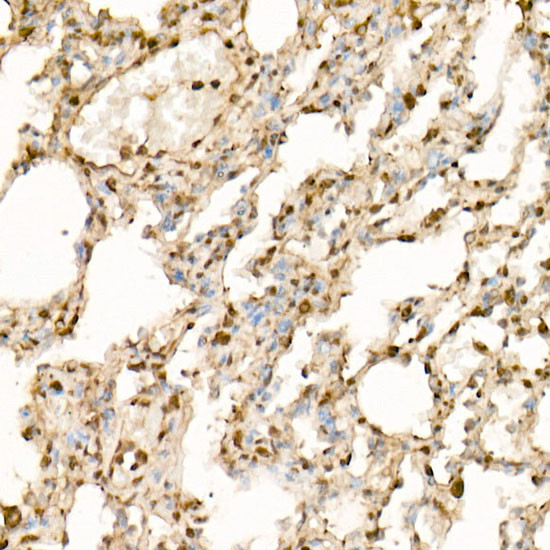 EIF4A1/EIF4A2/EIF4A3 Antibody in Immunohistochemistry (Paraffin) (IHC (P))