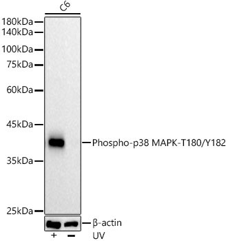 Phospho-p38 MAPK (Thr180, Tyr182) Antibody in Western Blot (WB)