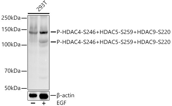 Phospho-HDAC4/HDAC5/HDAC9 (Ser246, Ser259, Ser220) Antibody in Western Blot (WB)