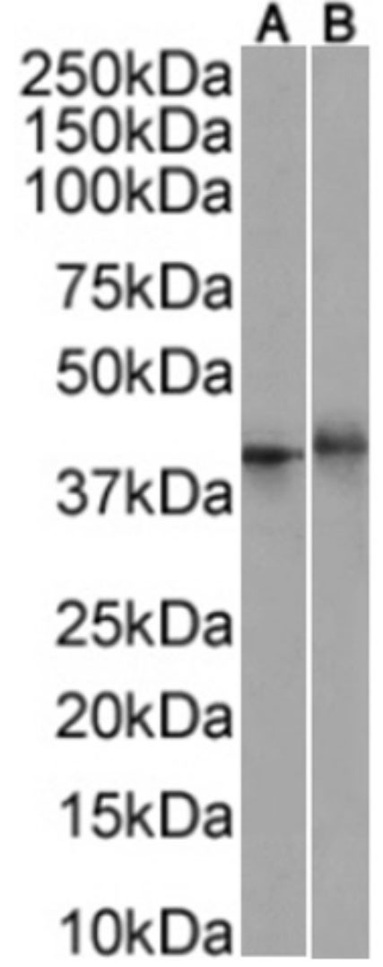 CD137 Chimeric Antibody in Western Blot (WB)