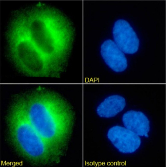 TRAIL-R2 (DR5) Chimeric Antibody in Immunocytochemistry (ICC/IF)