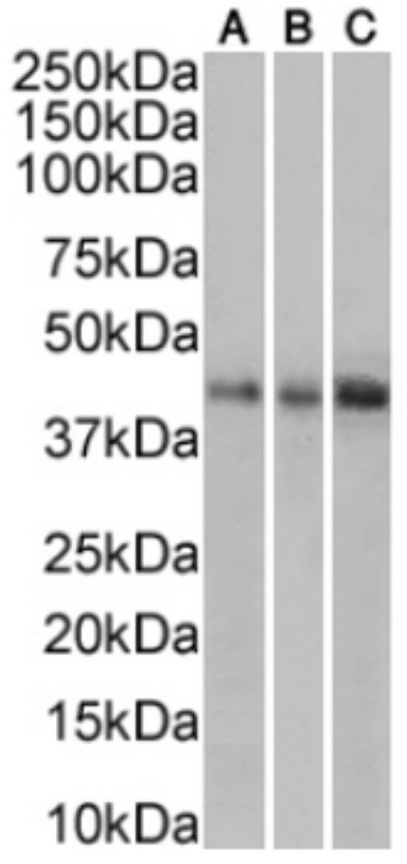 TRAIL-R2 (DR5) Chimeric Antibody in Western Blot (WB)