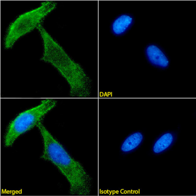 NG2 Chimeric Antibody in Immunocytochemistry (ICC/IF)