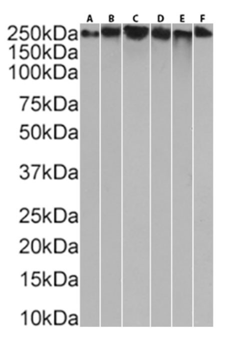 MUC1 Chimeric Antibody in Western Blot (WB)