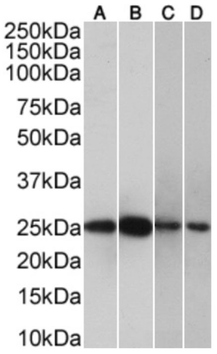 CRP Chimeric Antibody in Western Blot (WB)