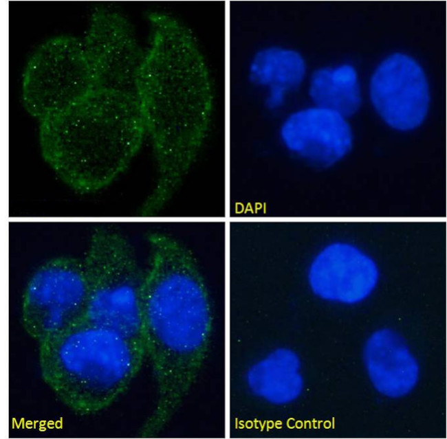 EDAR Antibody in Immunocytochemistry (ICC/IF)