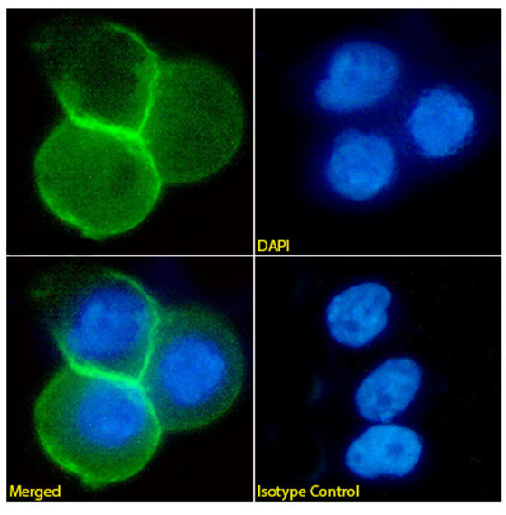 Desmoglein 3 Antibody in Immunocytochemistry (ICC/IF)