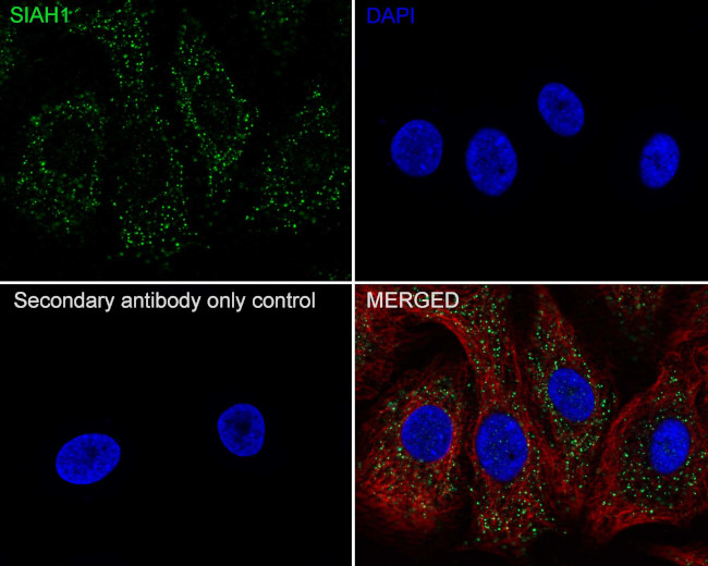 SIAH1 Antibody in Immunocytochemistry (ICC/IF)