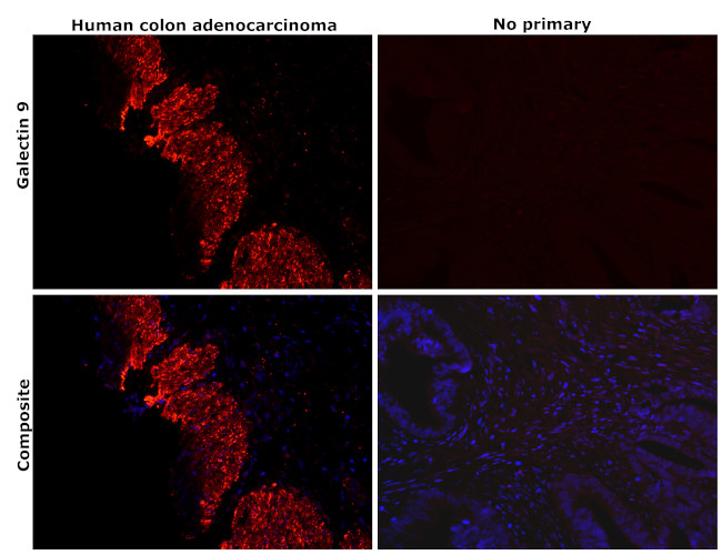 Galectin 9 Antibody in Immunohistochemistry (Paraffin) (IHC (P))