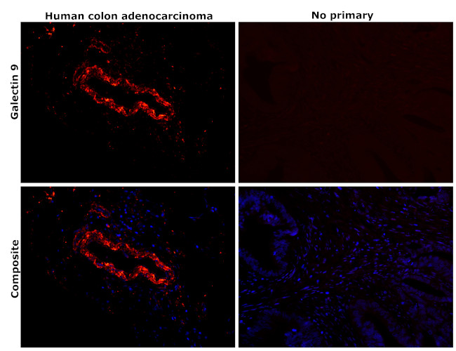 Galectin 9 Antibody in Immunohistochemistry (Paraffin) (IHC (P))