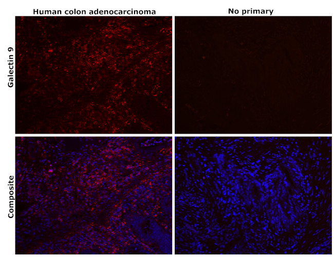 Galectin 9 Antibody in Immunohistochemistry (Paraffin) (IHC (P))