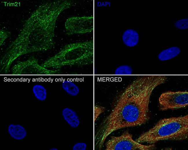 TRIM21 Antibody in Immunocytochemistry (ICC/IF)