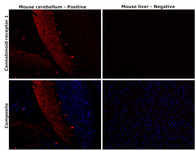 Cannabinoid Receptor 1 Antibody in Immunohistochemistry (Paraffin) (IHC (P))