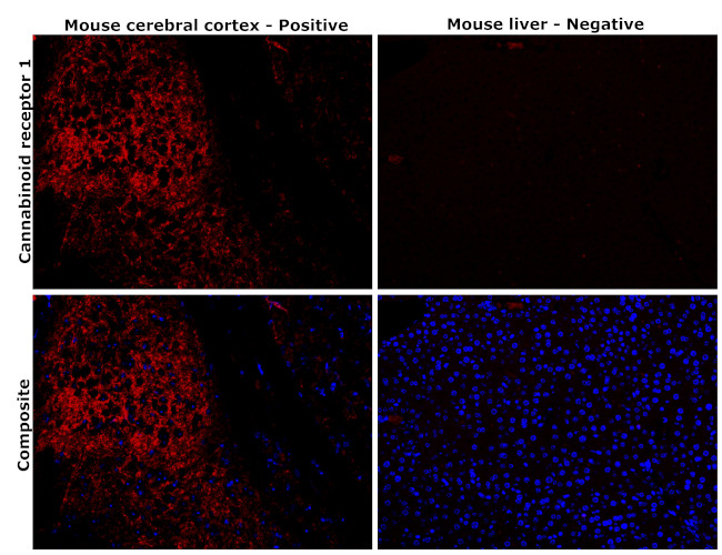 Cannabinoid Receptor 1 Antibody in Immunohistochemistry (Paraffin) (IHC (P))