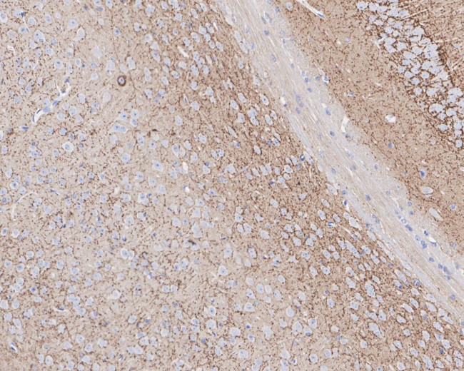 Cannabinoid Receptor 1 Antibody in Immunohistochemistry (Paraffin) (IHC (P))