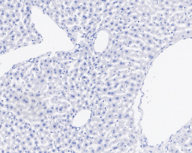 Cannabinoid Receptor 1 Antibody in Immunohistochemistry (Paraffin) (IHC (P))