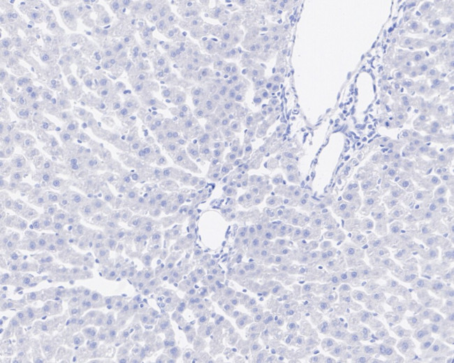 Cannabinoid Receptor 1 Antibody in Immunohistochemistry (Paraffin) (IHC (P))