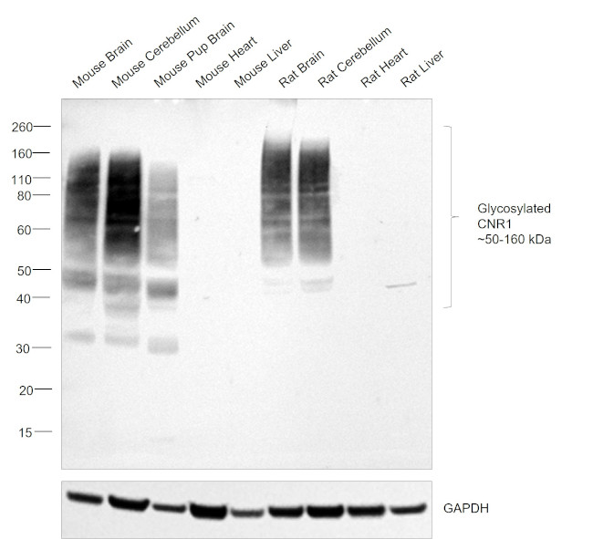 Cannabinoid Receptor 1 Antibody