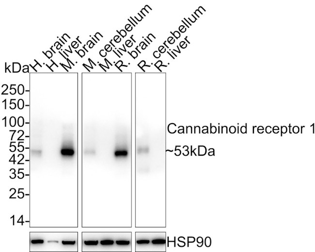 Cannabinoid Receptor 1 Antibody in Western Blot (WB)