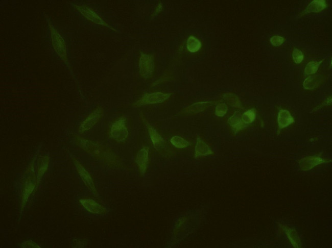 VEGF Receptor 1 Antibody in Immunocytochemistry (ICC/IF)