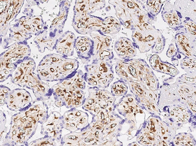 Galectin 1 Antibody in Immunohistochemistry (Paraffin) (IHC (P))