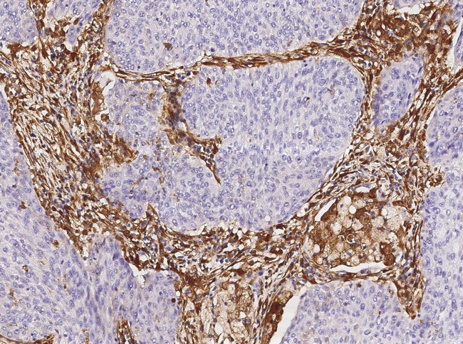 Galectin 1 Antibody in Immunohistochemistry (Paraffin) (IHC (P))