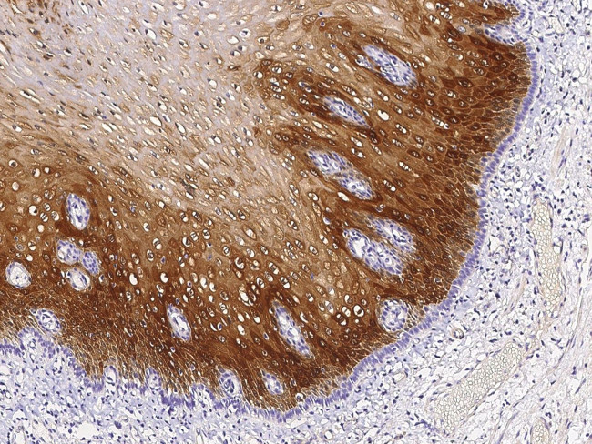 CRABP2 Antibody in Immunohistochemistry (Paraffin) (IHC (P))