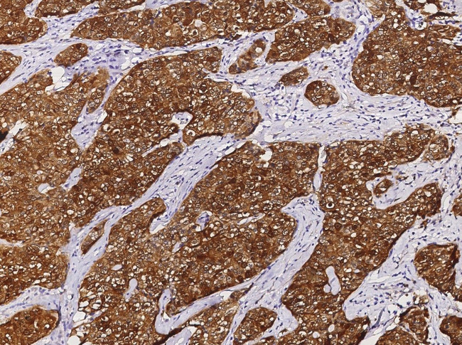 CRABP2 Antibody in Immunohistochemistry (Paraffin) (IHC (P))