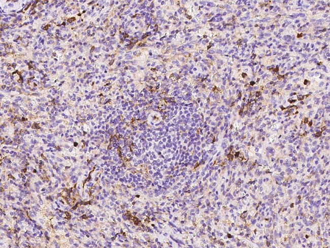 CD162 Antibody in Immunohistochemistry (Paraffin) (IHC (P))