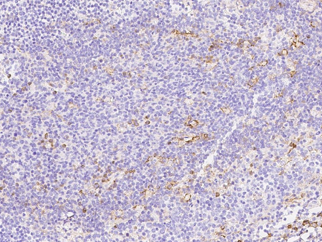 CD162 Antibody in Immunohistochemistry (Paraffin) (IHC (P))