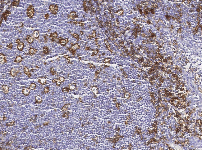 CD162 Antibody in Immunohistochemistry (Paraffin) (IHC (P))