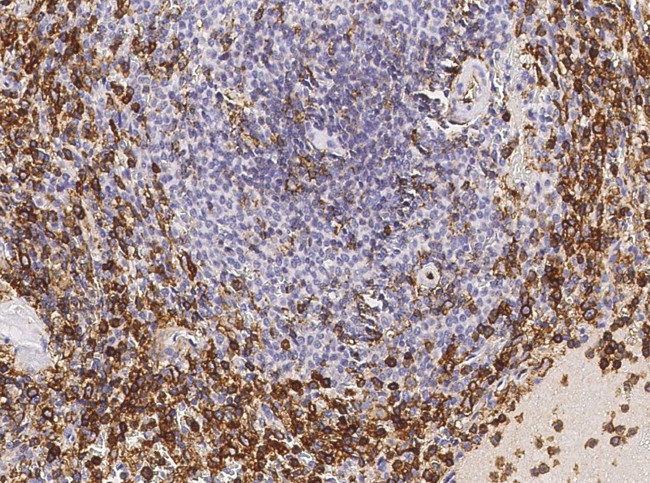 CD162 Antibody in Immunohistochemistry (Paraffin) (IHC (P))