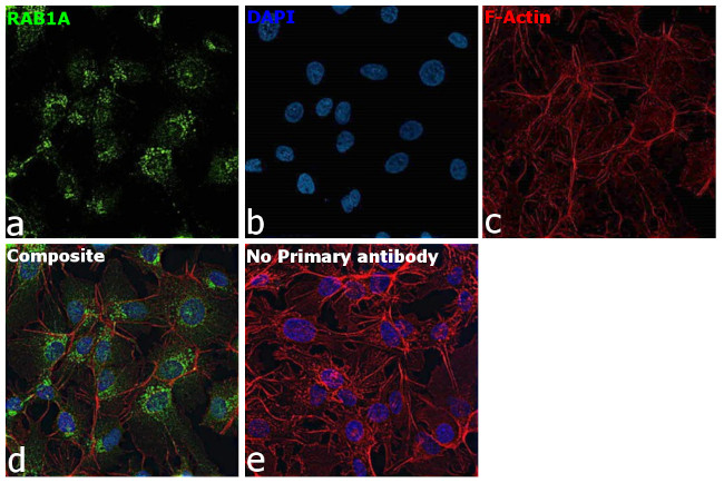 RAB1A Antibody in Immunocytochemistry (ICC/IF)