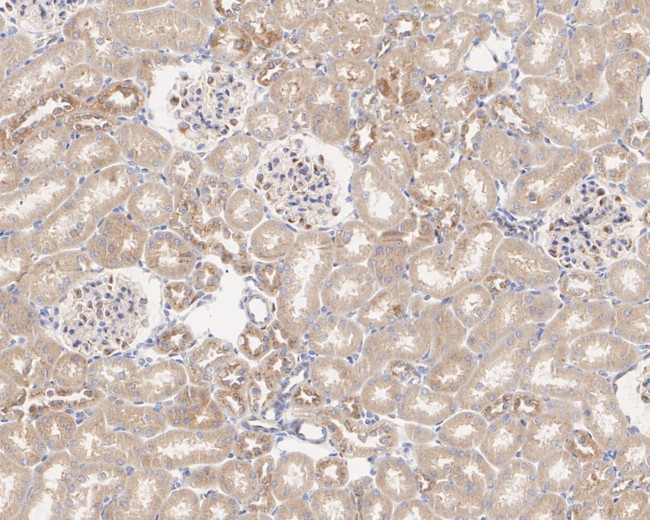 RAB1A Antibody in Immunohistochemistry (Paraffin) (IHC (P))