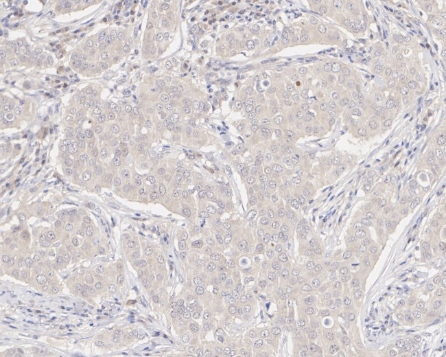 XIAP Antibody in Immunohistochemistry (Paraffin) (IHC (P))