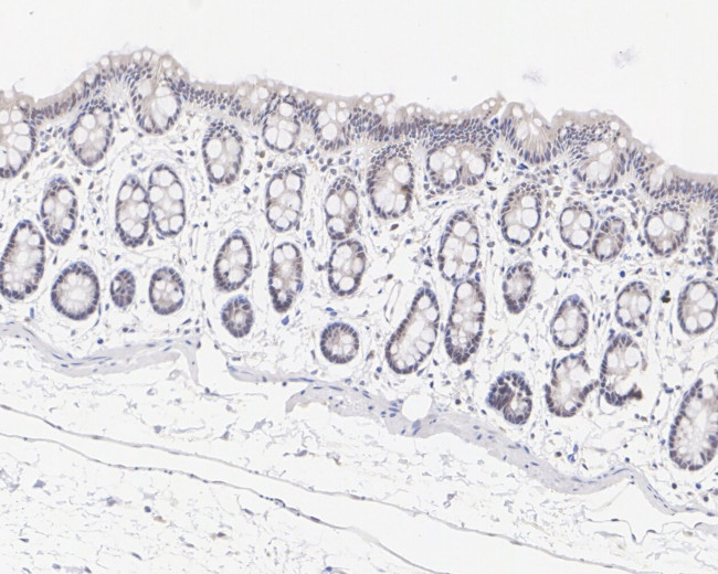 XIAP Antibody in Immunohistochemistry (Paraffin) (IHC (P))