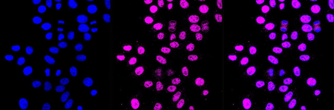 PLA2G2A Antibody in Immunocytochemistry (ICC/IF)