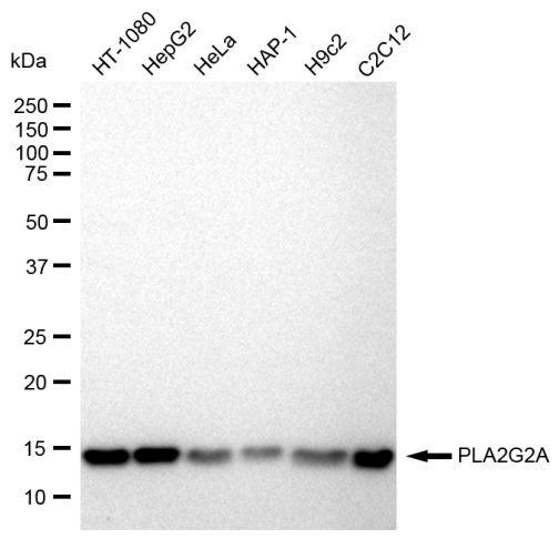 PLA2G2A Antibody in Western Blot (WB)