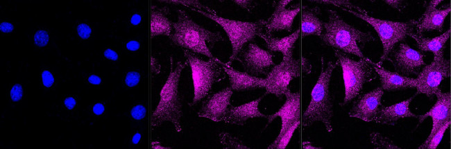 Caspase 7 Antibody in Immunocytochemistry (ICC/IF)