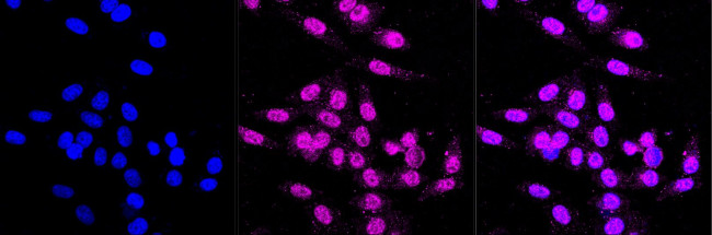 Caspase 7 Antibody in Immunocytochemistry (ICC/IF)