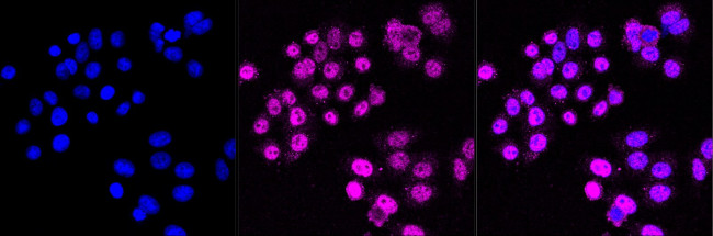 IKK epsilon Antibody in Immunocytochemistry (ICC/IF)