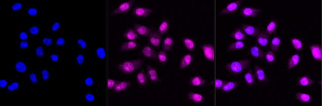 c-Rel Antibody in Immunocytochemistry (ICC/IF)