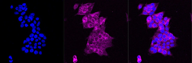 N-WASP Antibody in Immunocytochemistry (ICC/IF)