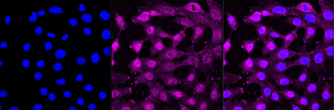 AKT Pan Antibody in Immunocytochemistry (ICC/IF)