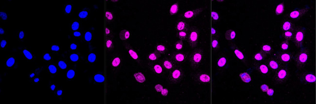 ACVR1 Antibody in Immunocytochemistry (ICC/IF)