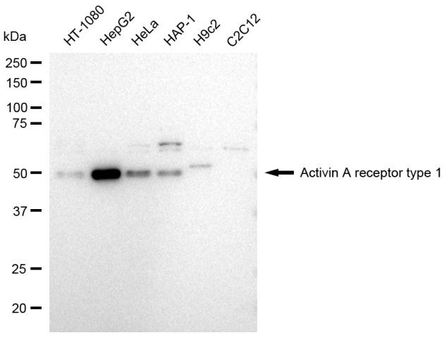 ACVR1 Antibody in Western Blot (WB)